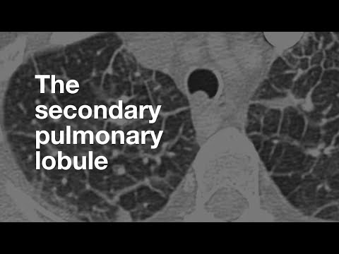 The Secondary Pulmonary Lobule