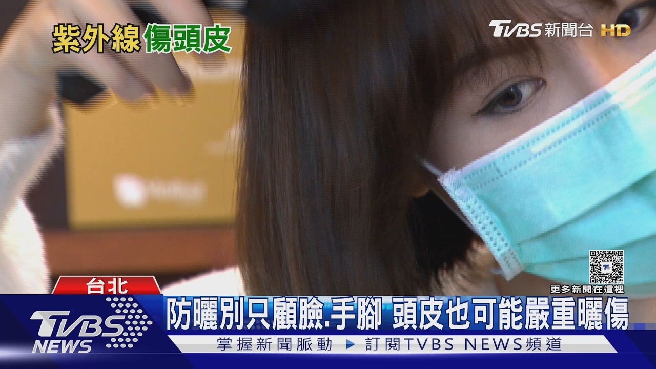 夏天防曬別漏頭皮!經常「做這件事」長期曝曬 恐曬傷、局部落髮