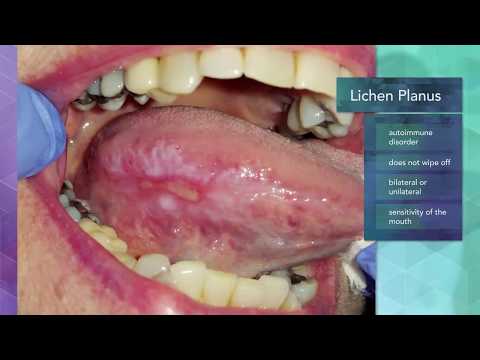 Diagnosing Oral and Maxillofacial Diseases/Pathology