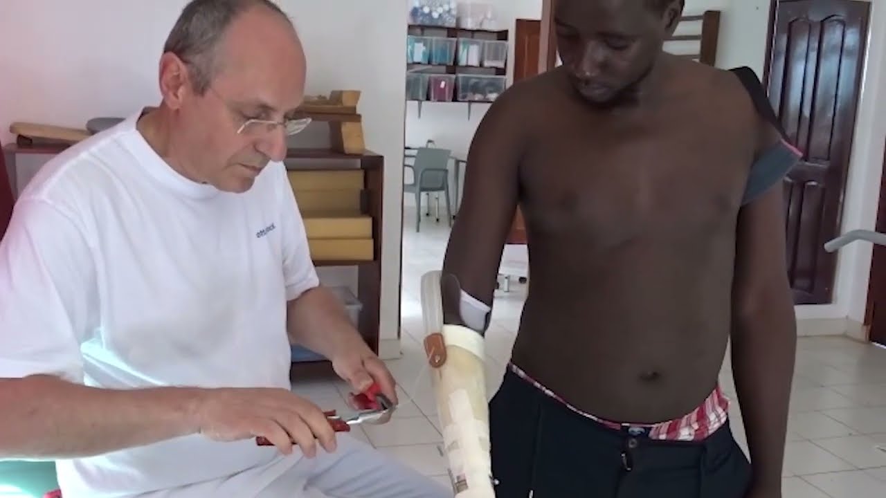 Eine Handprothese für den Alltag