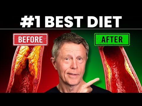 #1 Best Diet To Clean Your Arteries (Not What You Think)