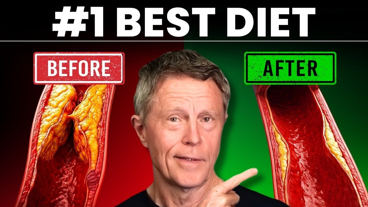 #1 Best Diet To Clean Your Arteries (Not What You Think)