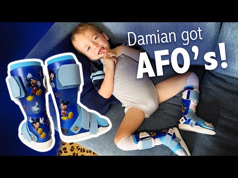 How They Made Custom AFO's (ankle braces) for My 2-Year-Old