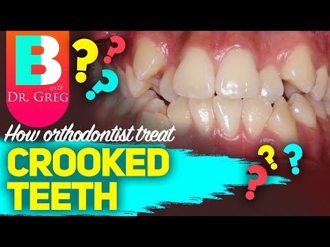 Crooked Teeth and Braces