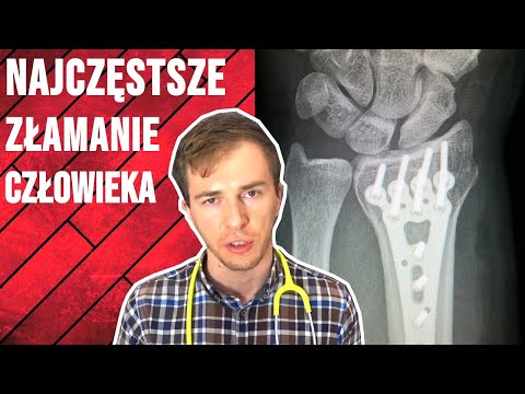 Najczęstsze złamanie - Złamanie nasady dalszej kości promieniowej