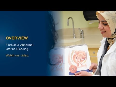 Understanding fibroids and abnormal uterine bleeding
