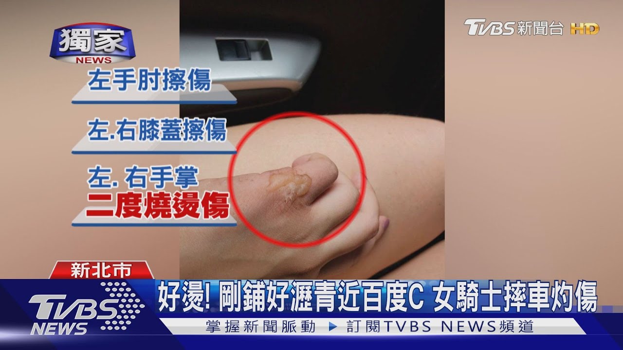 好燙! 剛鋪好瀝青近百度C女騎士摔車灼傷