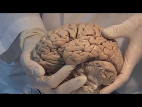Introduction  Neuroanatomy Video Lab   Brain Dissections