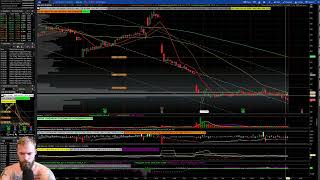 Common Options Trading Questions | Options Trading Basics