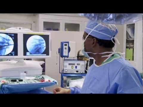Minimally Invasive Spine Surgery for Spinal Stenosis