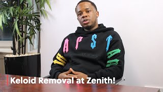 Keloid Removal here at Zenith!