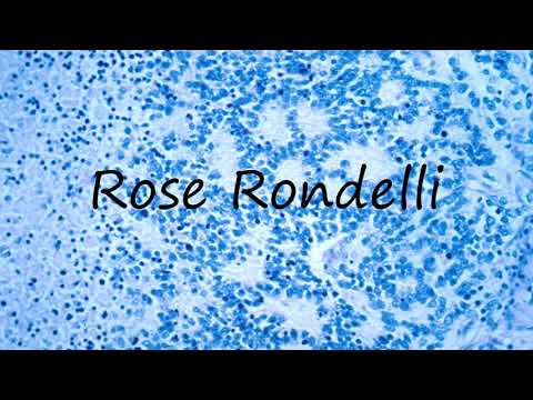How to Pronounce Rose Rondelli?