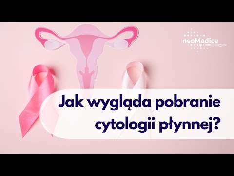 Jak wygląda pobranie cytologii płynnej?