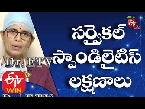 Cervical Spondylosis | Cervical Spondylosis Treatment | Spondylosis Physical Therapy