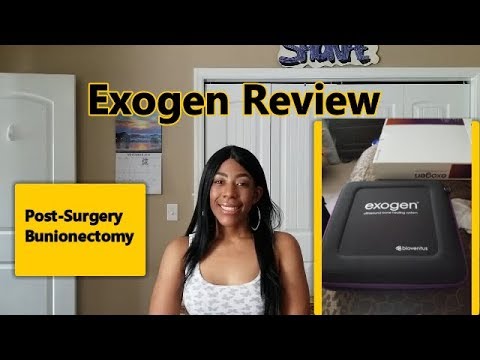 EXOGEN Ultrasound Bone Healing System Review + TUTORIAL | How To Use | Post BUNION Surgery Recovery