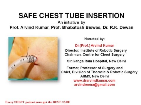 Safe chest tube insertion -- talk by Dr. (Prof.) Arvind Kumar
