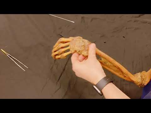 Gelenke der Oberen Extremität Einleitung - Anatomie kurz und knackig