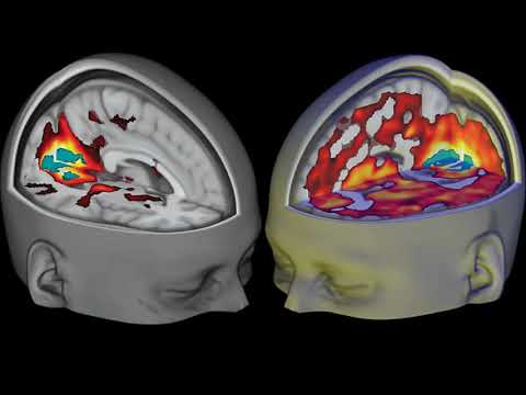 Archeos - Untangling The Senses