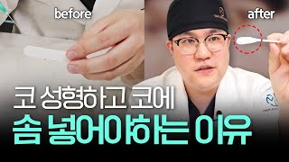 코 성형 후 코 막는 솜, 빼고 싶다면 이 영상 보세요.