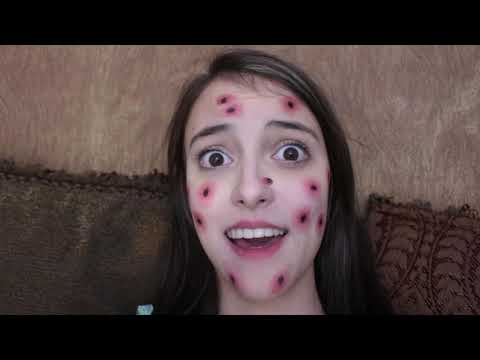 Kaelyn Has A VERY Weird Illness! Video