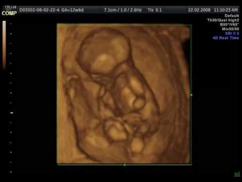 Ecografia 4D: feto a 12 settimane