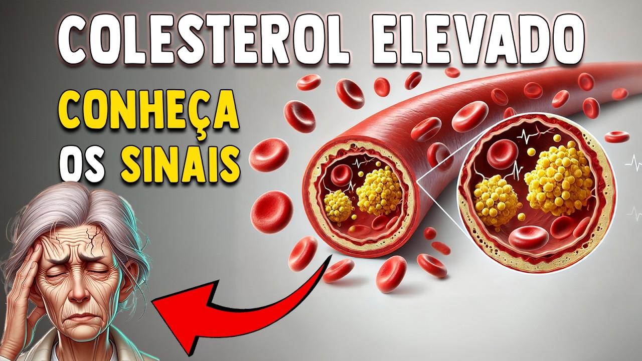 7 SINAIS que seu corpo dá sobre COLESTEROL ALTO!