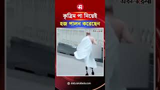 কৃত্রিম পা নিয়েই হজ পালন করেছেন তিনি | Daily Sakalbela
