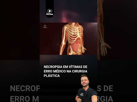 NO IML: ÓBITOS DE ERROS MÉDICOS EM CIRURGIAS PLÁSTICAS