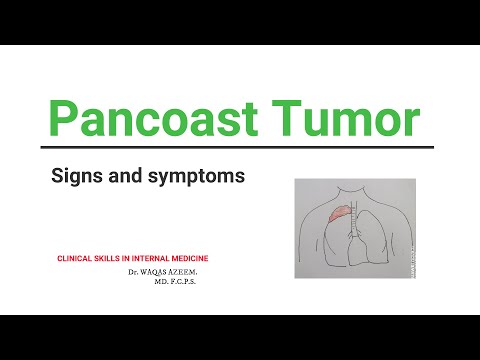 Végbél daganatok, végbélrák tünetei, kivizsgálása