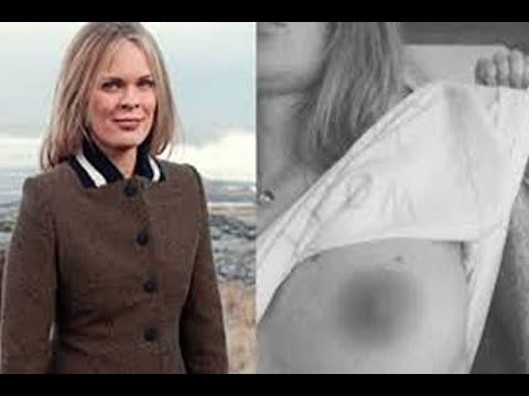 Diputada islandesa enseña pezón para protestar