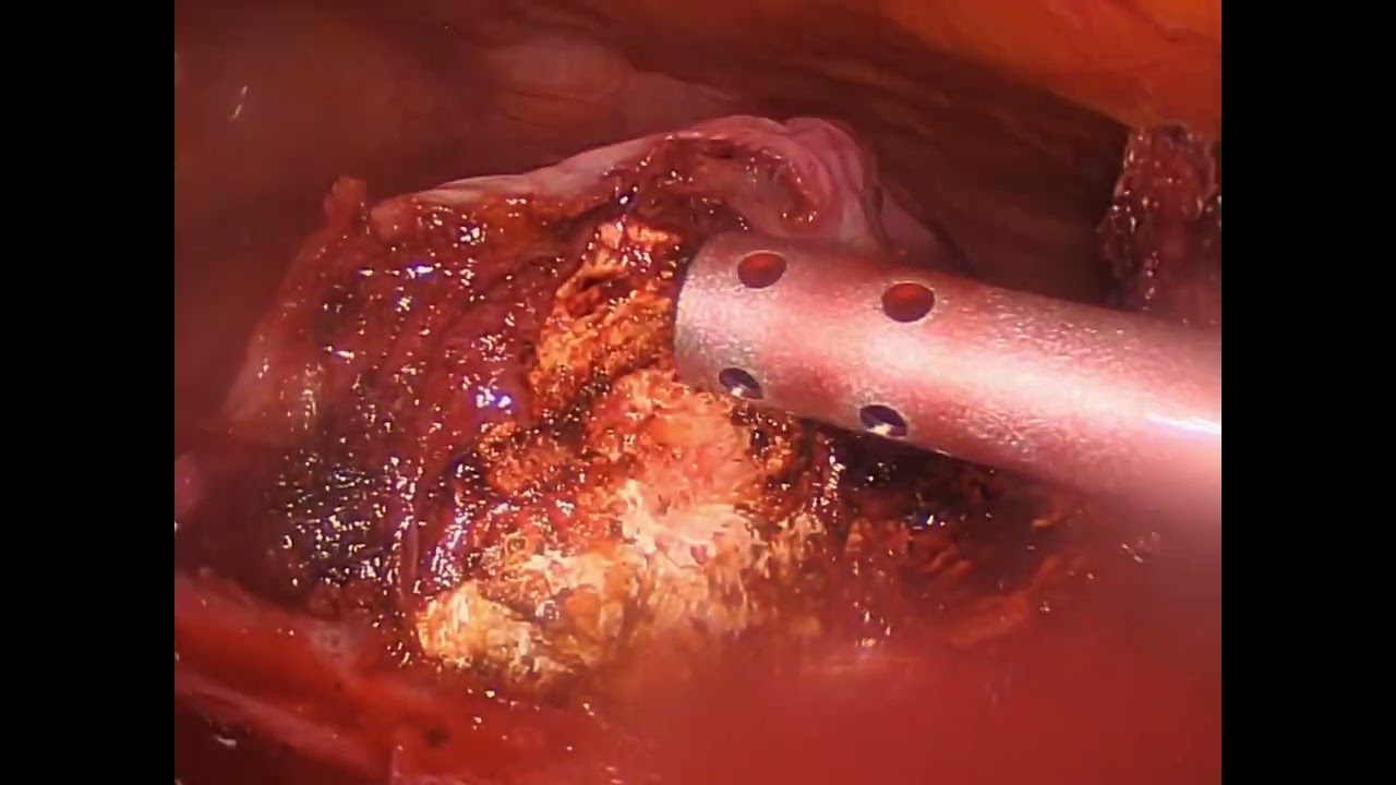 Ángel Millán Juárez-97