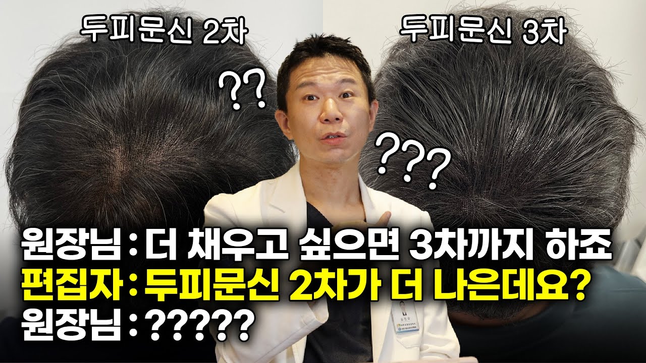  정수리 두피문신 리터치의 중요성 (머리카락 착시효과 보고 가세요) [ENG JP SUB]