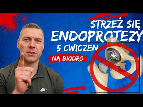 jak uniknąć ENDOPROTEZY - ratunek dla Twoich bioder