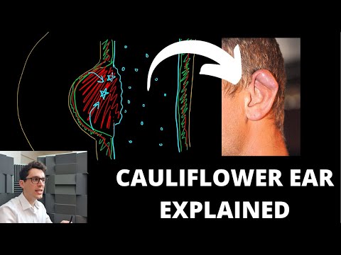 What Causes Cauliflower Ear?