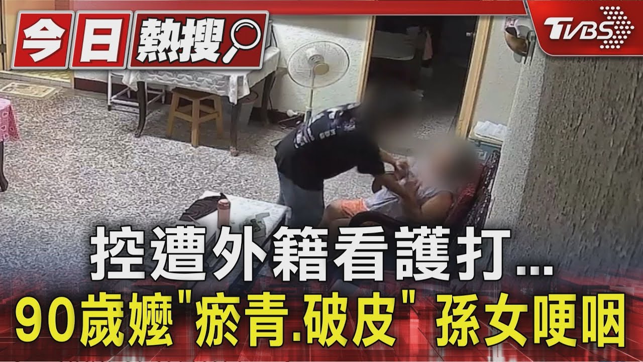 獨/90歲失智奶奶遭施暴?手臂現瘀青 控被指甲掐肉
