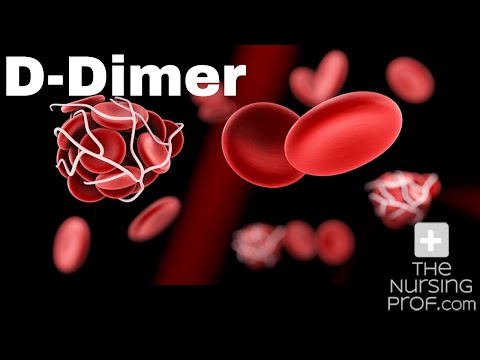 What the D Dimer test tells you.