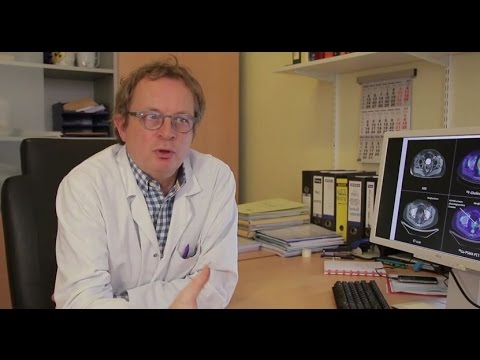 Détecter une récidive du cancer de la prostate : le PSMA PET-scan