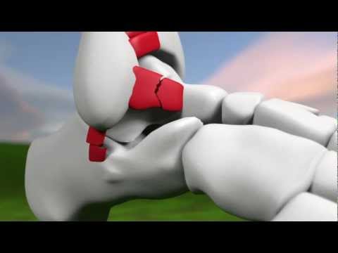 Ankle Sprain Injury Explained