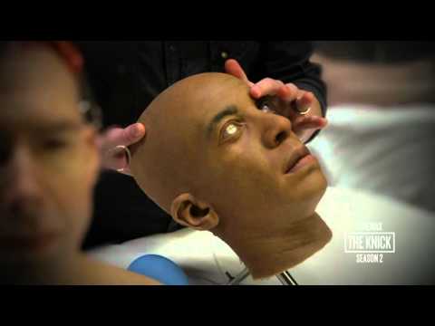 The Knick Season 2: Body Shop Algernon Eye Surgery (Cinemax)