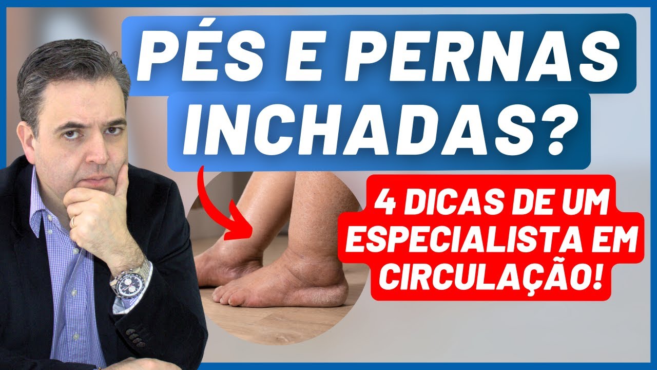 Pés e pernas inchadas - Causas e 4 dicas importantes! - Dr. Alex Vascular