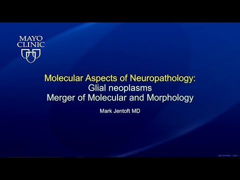 Glial Neoplasms Merger of Molecular Morphology by Mark E. Jentoft, MD | Preview