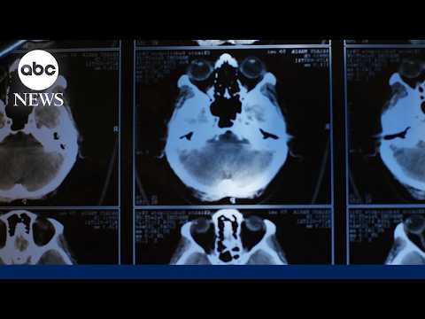 NFL players weigh CTE risks against love of the game