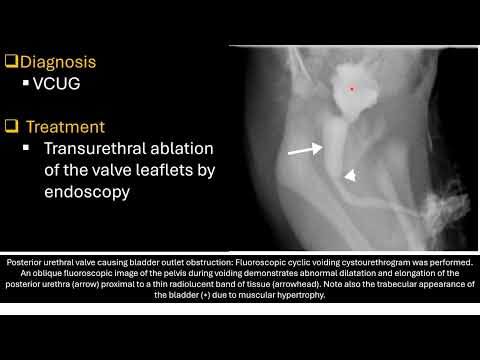 Pediatric Urology Preview