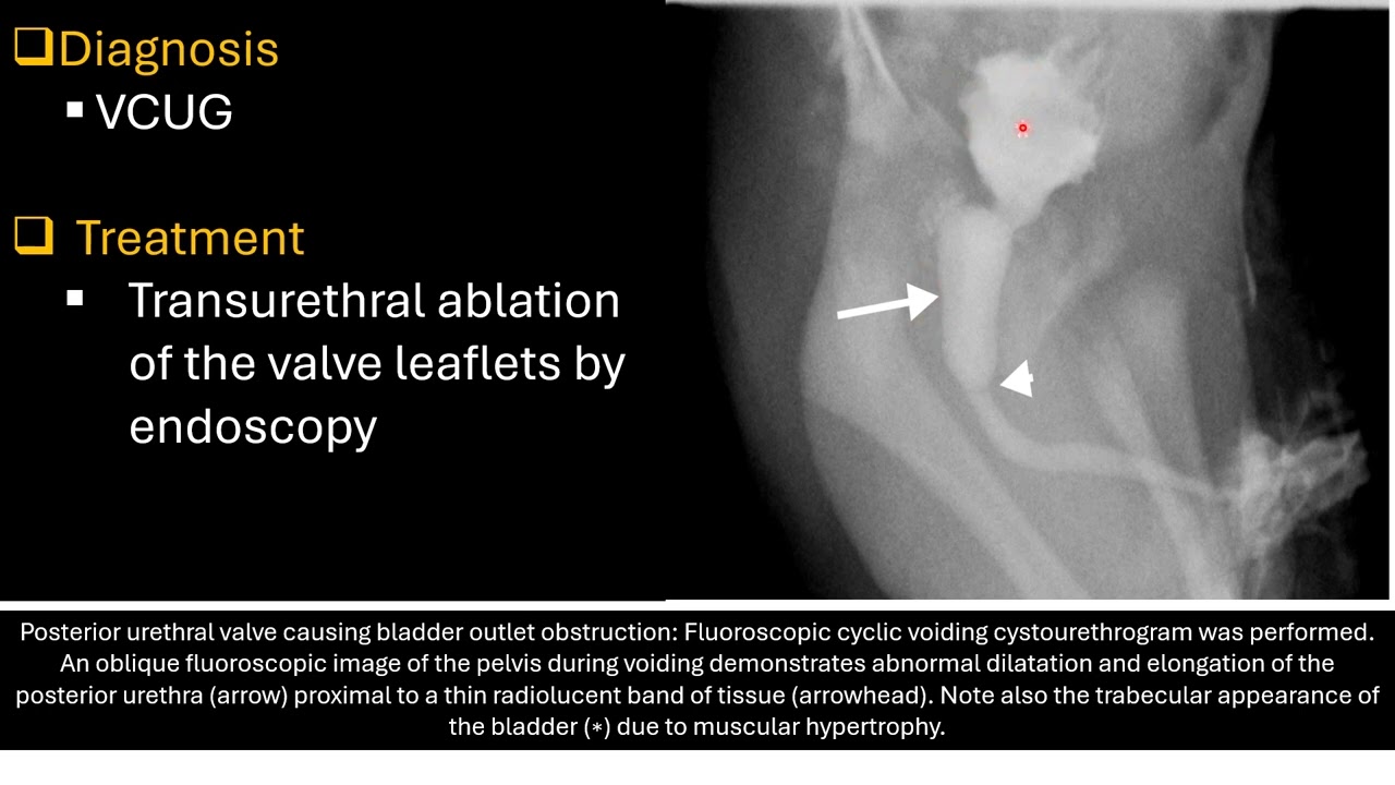 Pediatric Urology Preview
