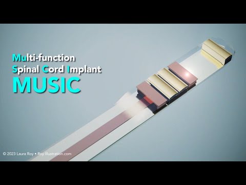 MUSIC: Spinal Cord Implant Ultrasound System