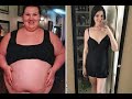 145 Pound Weight Loss Transformation Before And After Photos Videos S1E16 Subscribe Lossweight
