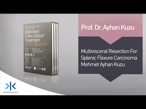 2.2.3.Multivisceral Resection - Subtotal Colectomy - Werner Hohenberger & M. Ayhan Kuzu