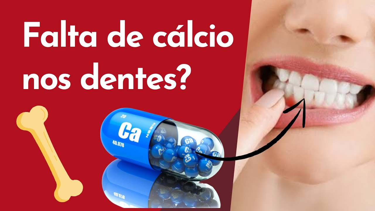 FALTA DE CÁLCIO NOS DENTES ? | Resumos de Odonto