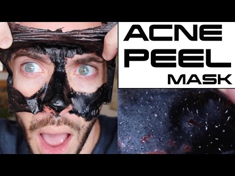 DIY ACNE PEEL OFF MASK USING GLUE??? Does This Sh!t Really Work? | Cheap Tip #258 Video