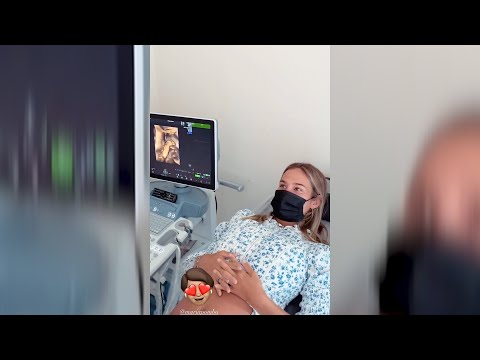 María Pombo luce emocionada al ver a Martín en una nueva ecografía